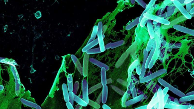 Molecular Analysis of Pseudomonas